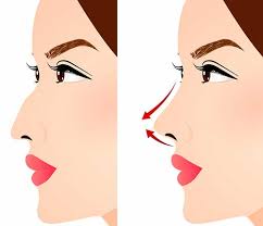 رینوپلاستی-دکتر نرگس واسعی